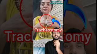 Tracheostomy shorts [upl. by Latsirhc]