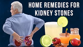 Home Remedies for Kidney Stones [upl. by Intihw]