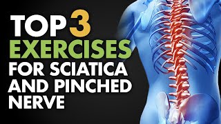 Top 3 Exercises for Sciatica and Pinched Nerve [upl. by Inaffets]