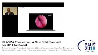 PLASMA Enucleation A New Gold Standard for BPH Treatment [upl. by Mast477]