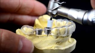 Dental implant surgical guide drilling protocol [upl. by Quick653]