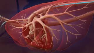 Heartworm Life Cycle for Professionals [upl. by Christensen]