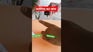 malaria test  malaria test slide method hindi [upl. by Yeffej693]