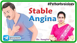 Stable Angina Causes Pathophysiology Symptoms Diagnosis and Treatment  Internal medicine [upl. by Cost]