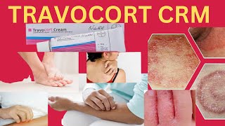 Travocort cream  How to use travocort cream  Fungal infection travocort cream [upl. by Anitnegra]