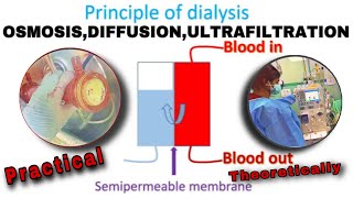 Principle of Hemodialysis  How Dialysis Works [upl. by Trstram]