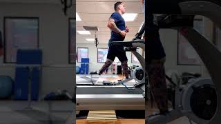 Double amputee running on treadmill with brand new running blades [upl. by Walcott]