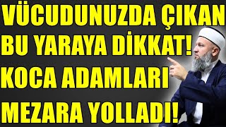 BU HASTALIK KOCA ADAMLARI DEVİRDİ ŞU 3 HASTA ZİYARET EDİLMEZ Hüseyin ÇEVİK [upl. by Akalam]