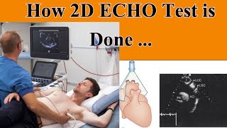 How 2D ECHO Test is Done Explain in Hindi [upl. by Brownley26]