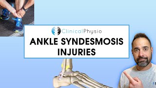 Ankle Syndesmosis Injuries  Expert Physio Overview [upl. by Allana]