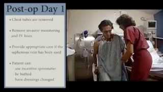 Acute Coronary Syndrome  Bypass Surgery DOS amp Postoperative Care [upl. by Noreg]