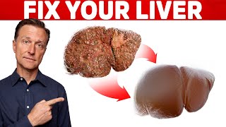 The 6 Best Ways to Heal a Fatty Liver [upl. by Rennat]