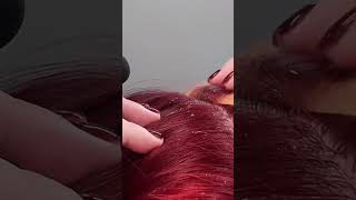 ASMR Scalp Exfoliation amp Dandruff Removal  Ultimate Relaxation No Talking asmr scalping [upl. by Nnaesor]