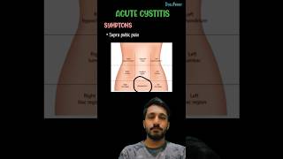 Acute cystitis SymptomsCauses amp treatmentcystitisurinarysystembladderinformationmedicalmbbs [upl. by Audley]