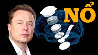 728 Sự Thật Về Chip Não Biến Người Thường Thành quotSiêu Nhânquot Của Elon Musk [upl. by Wooster891]