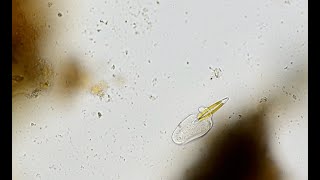 Ciliate eating a diatom [upl. by Skyla]