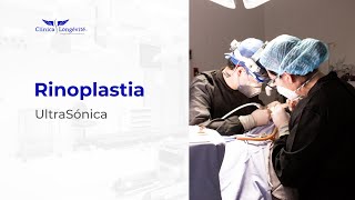 Rinoplastia Ultrasónica  Clínica Longévité  Morelia  Querétaro  Guadalajara  CDMX [upl. by Attaynek172]