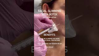 Botox facial slimming in Los Angeles Skin Tightening Botox and Lip Fillers by Skinsation LA [upl. by Meer]