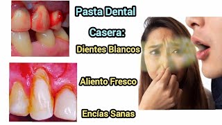 Pasta Dental Casera  A base De Hierbas Naturales [upl. by Gallagher174]