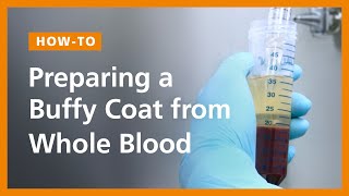 Preparing a Buffy Coat from Whole Blood [upl. by Drawe]