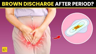 How To Stop Brown Discharge After Period  Causes amp Natural Remedies [upl. by Jeroma786]