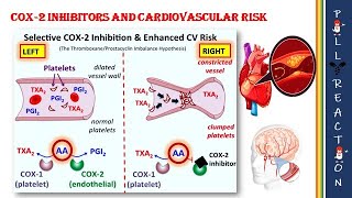 Celecoxib and its side effects  MOA  Stroke  MI [upl. by Eelidnarb]