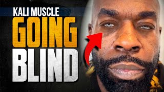 Kali Muscle Going BLIND From DANGEROUS Surgery [upl. by Asselam]