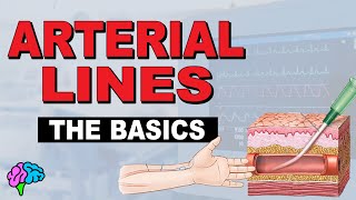 What is an Aline Arterial Line Basics EXPLAINED [upl. by Earle]