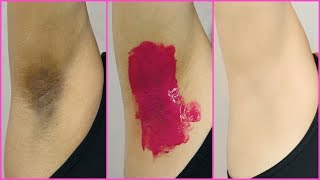 How To Lighten Dark Underarms PERMANENTLY  100 Naturally  Anaysa [upl. by Avera]