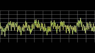 Myoclonus  Rife Frequencies [upl. by Nylhsoj98]