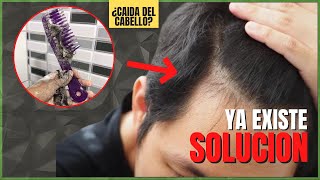 Como Evitar La Caida Del Cabello  TOP 7 Metodos Comprobados Para Crecer El Cabello [upl. by Aikaj]