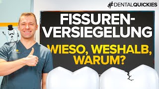 FISSURENVERSIEGELUNG  Was ist das Warum macht man es Wie läuft es ab [upl. by Illak]