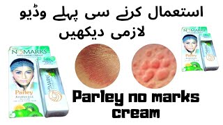 Parley no marks anti marks creamBenefitsdisadvantagesParley nomarks reviewGood or Bad [upl. by Idak732]