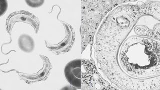 Enfermedad de Chagas y Esquistosomiasis [upl. by Curson]