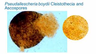 Identification of Melanized Dermatitiaceous Fungi Part 3 Hot Topic [upl. by Essirehc465]