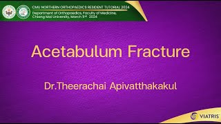 Acetabulum Fracture [upl. by Gillman326]