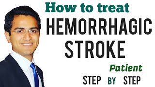 Hemorrhagic Stroke Intracerebral Hemorrhage Emergency Treatment Management Medicine Lecture USMLE [upl. by Puff]