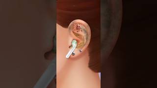 ASMR ear treatment  remove earbuds amp piercing animation clean earwax and worm [upl. by Issy438]