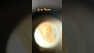 Liver flukeplatyhelminthesFlatwormsharda education world [upl. by Yelena]