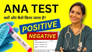 ANA Test क्यों किया जाता है Antinuclear Antibody Test in Hindi [upl. by Llenahc]