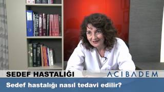 Sedef hastalığı nasıl tedavi edilir [upl. by Nylasej479]