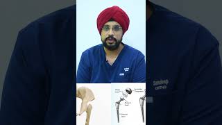 Revision Hip Replacement  Revision Hip Replacement surgery  Dr Sandeep Singh [upl. by Conny855]