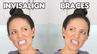 Braces or Invisalign Which is BETTER [upl. by Ailaham725]