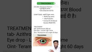 Trachoma treatment [upl. by Maon]