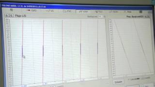 Volúmenes Pulmonares por Pletismografía corporal Prueba [upl. by Nitsed]