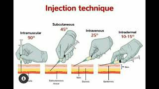 Injection Techniques quotIntermuscular Subcutaneous Intravenous Intradermalquot [upl. by Yramliw449]