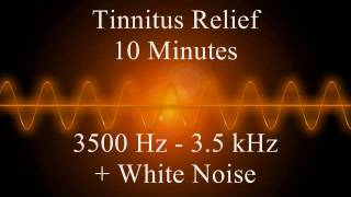 Tinnitus relief  10 minutes  3500 Hz  35 kHz  White Noise [upl. by Parish]