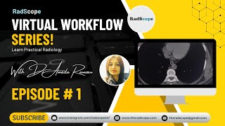 Virtual Workflow Series Episode  1 Altered bowel habits [upl. by Stalk574]