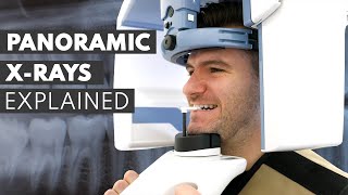 Panoramic Dental XRay Procedure EXPLAINED [upl. by Sweyn]