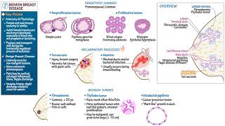 Benign Breast Diseases [upl. by Ayekin]